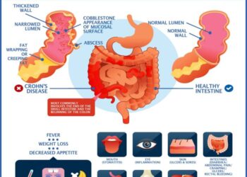 Crohn's Disease IBD Symptoms Advances Impact Causes