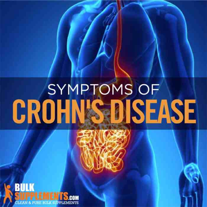 Crohn’s Disease: Symptoms, Causes and Support Strategies