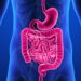 Study uses AI method for better insight into Crohn’s disease